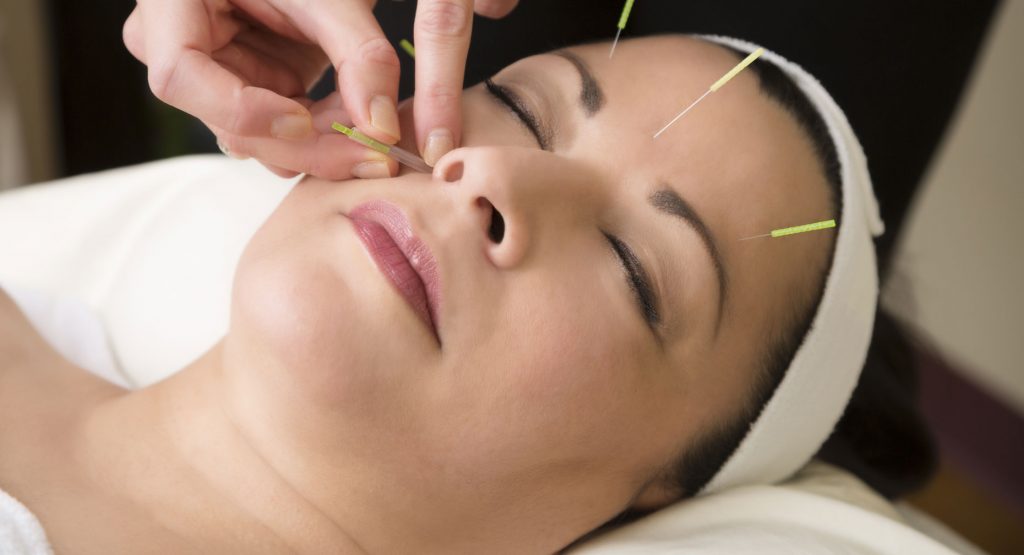 acupuncture needles at needle pro