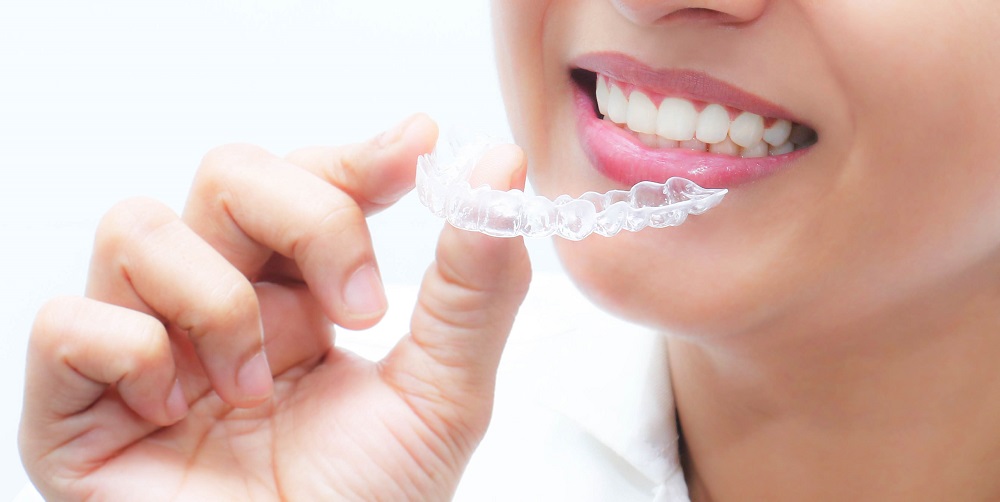 Methods of Whitening Teeth at Home with Bleaching